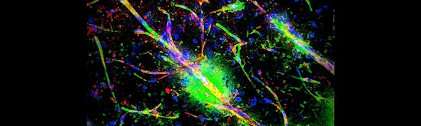 April Top Neuroscience Stories