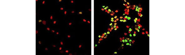 August Neuroscience Stories