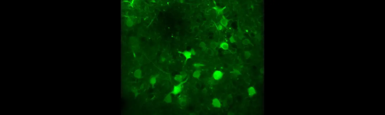 Multiphoton Microscope