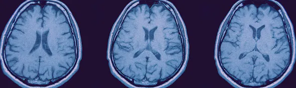 Brains MRI Banner