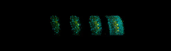 Fluorescence Lifetime Imaging – Another Dimension In Multiphoton Imaging