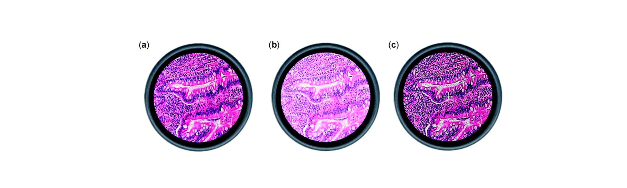 A 6 step guide to Koehler Illumination