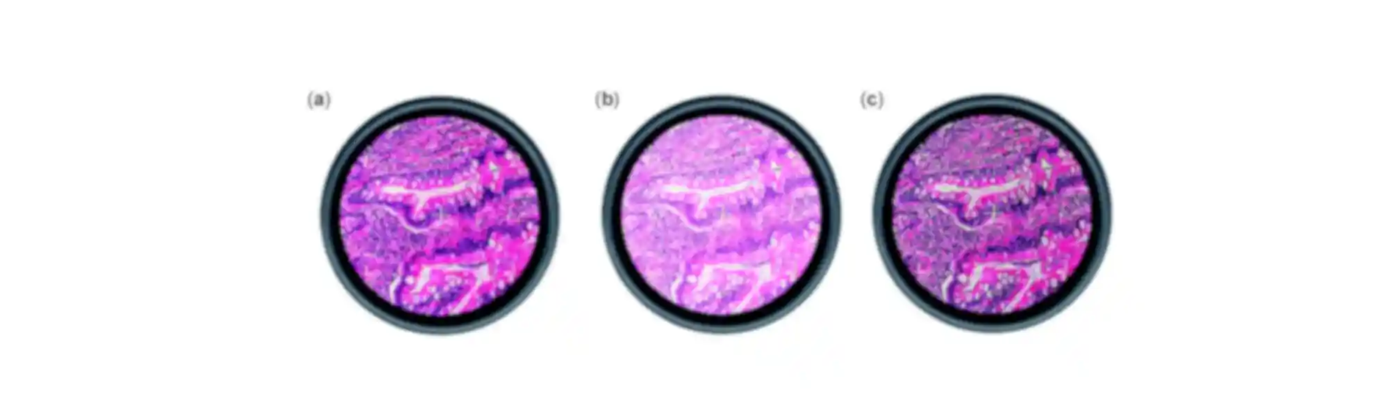 A 6 step guide to Koehler Illumination