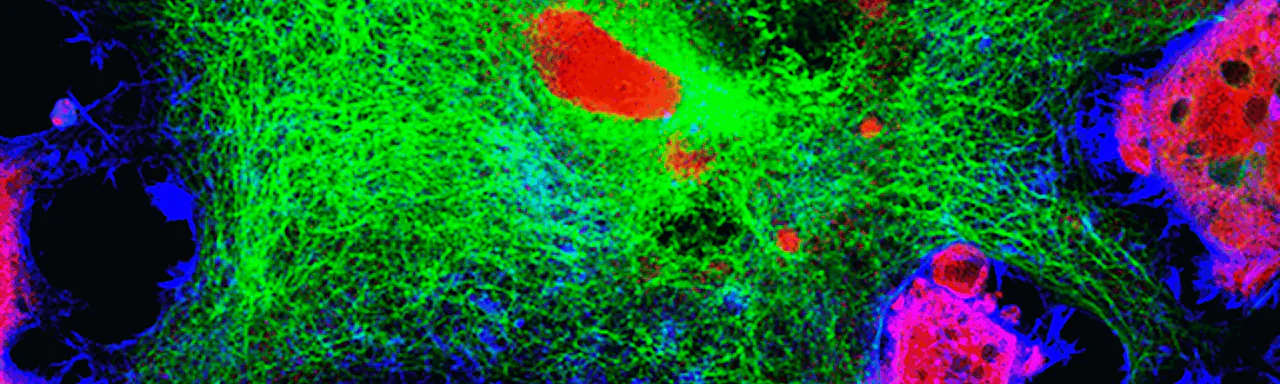 fluorescence microscopic view of mice neuroblastoma cell line