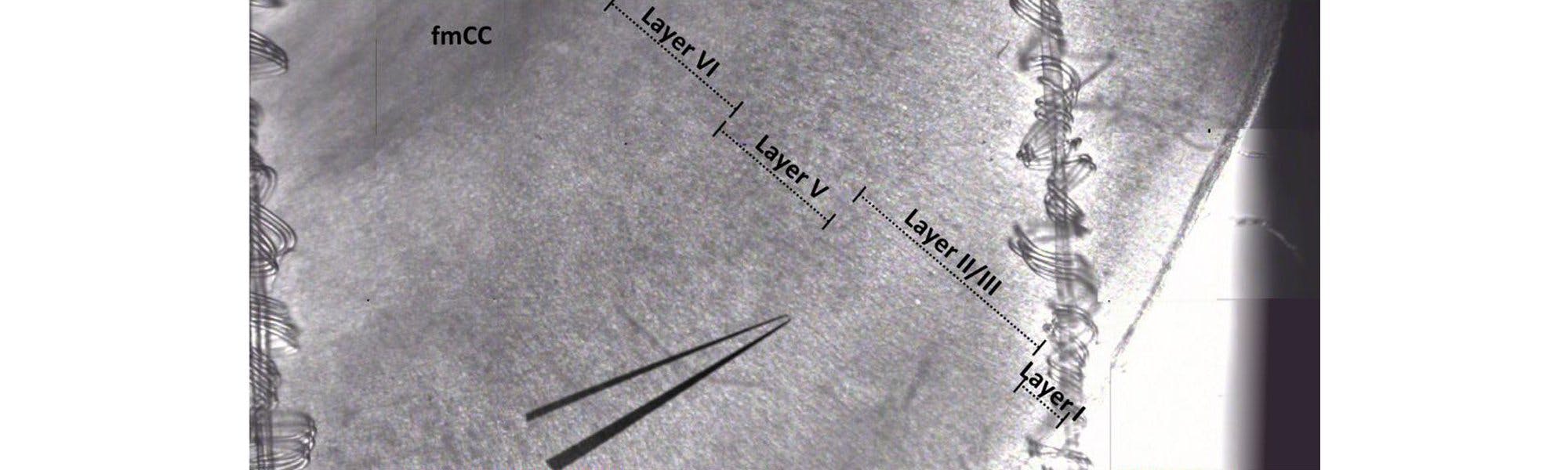 A guide to stitching images using MicroManager and ImageJ