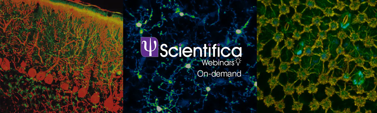 Watch on-demand: An introduction to in vivo multiphoton microscopy