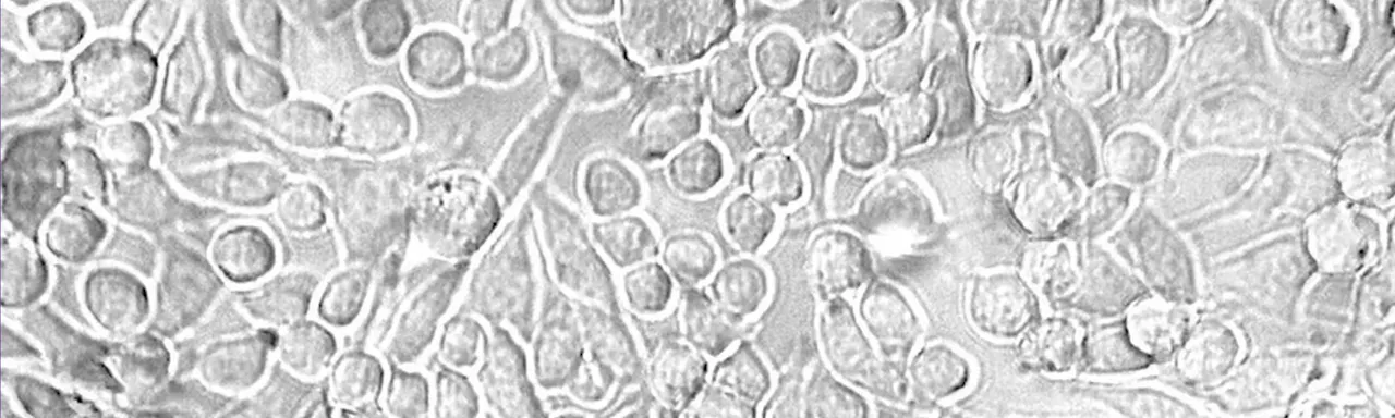 An example of Phase Contrast microscopy