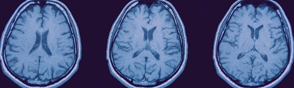 Brains MRI Banner