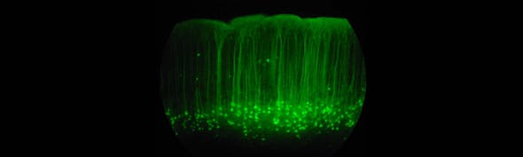 Gfp Expressing Somatosensory Cortex Credit Wikimedia Commons