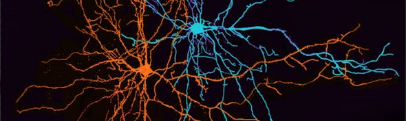 Positive-and-negative-neurons banner