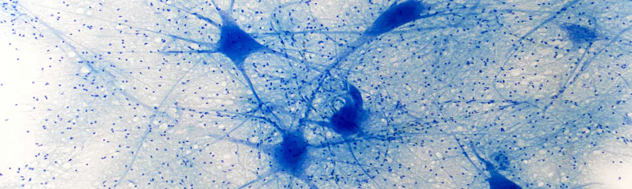 Scientifica's range of tools and equipment for cultured cell imaging.