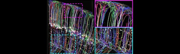 Top Neuroscience Stories Jan 2019