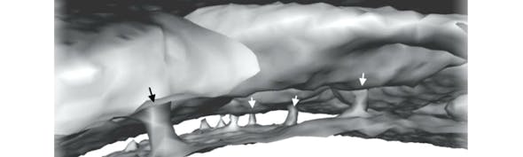 Tunnels Between Skull And Brain