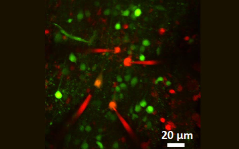 Two-Photon Image of Four Patch Clamped Neurons, with their Corresponding Pipette Tips