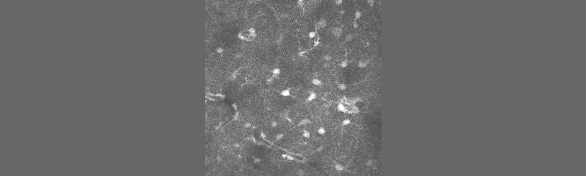 A three-photon image captured by the lab of Adam Packers, University of Oxford